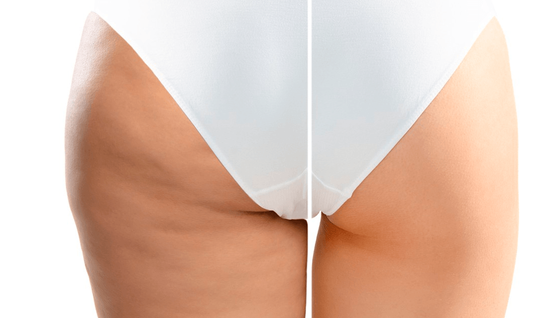 Beneficios visual
