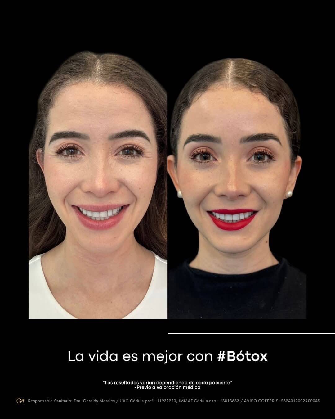 Resultado 1