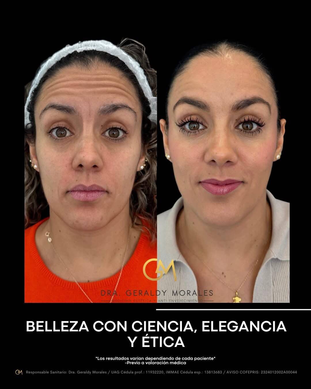 Resultado 2