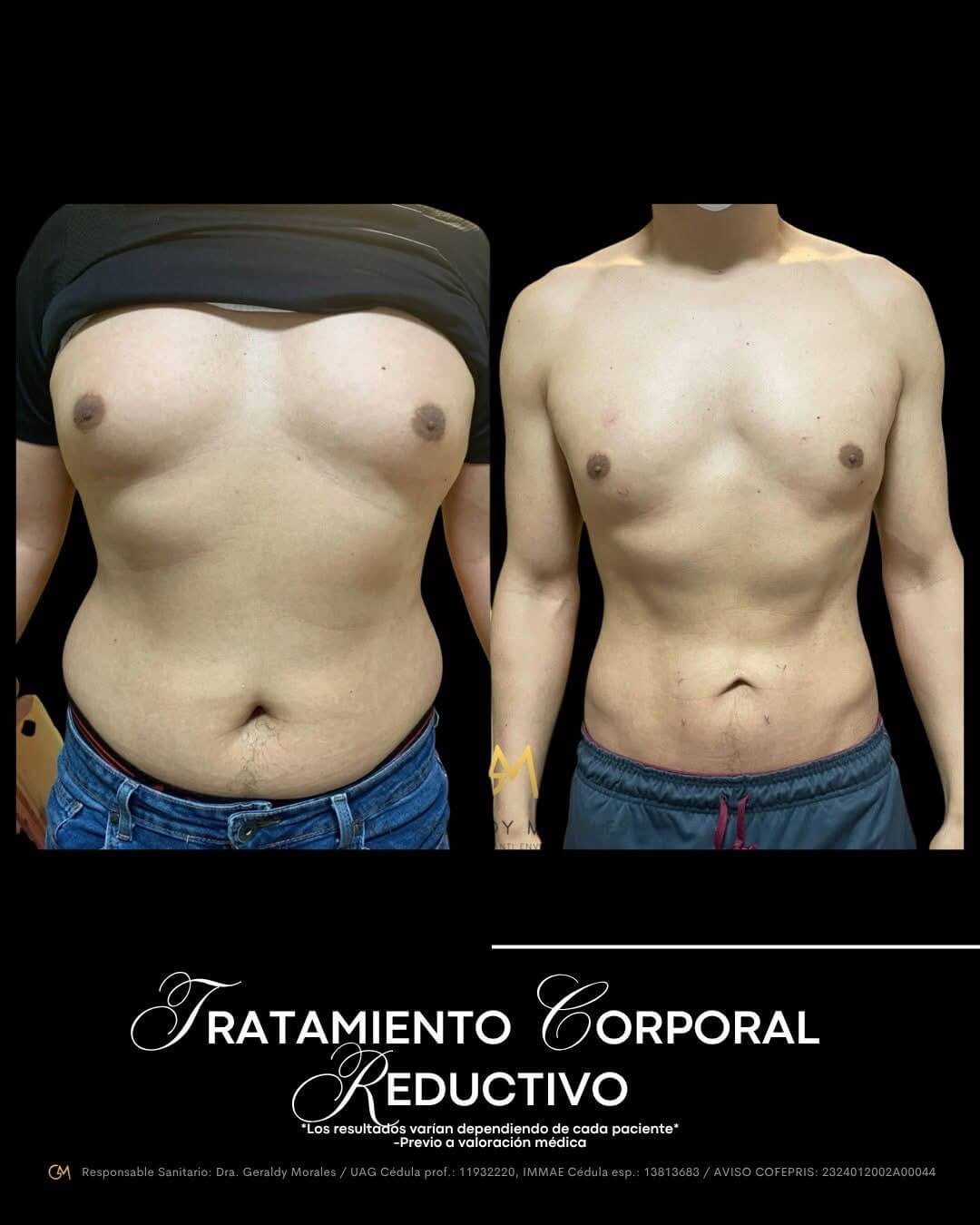 Resultado 3
