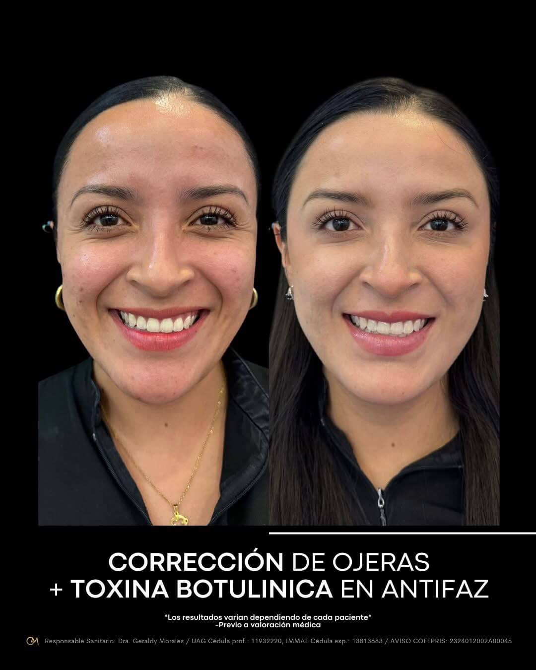 Resultado 4