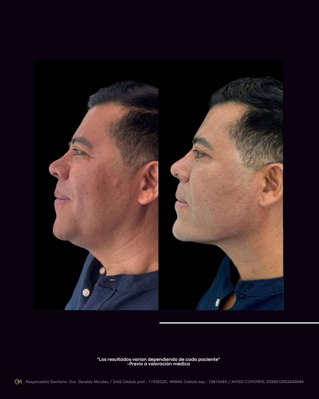 Resultado 6