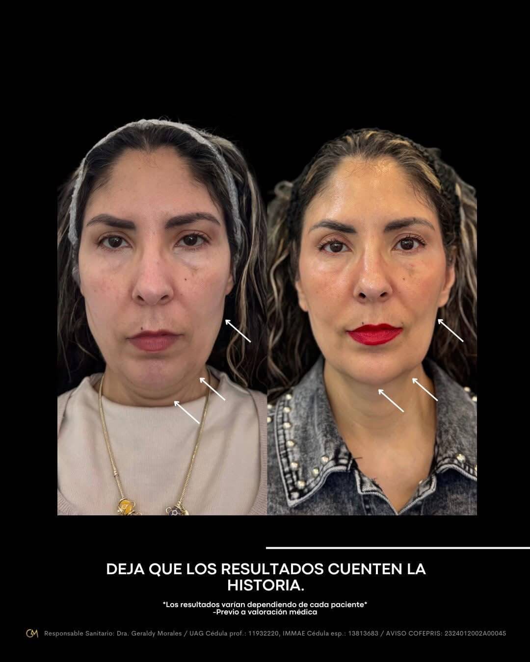 Resultado 7