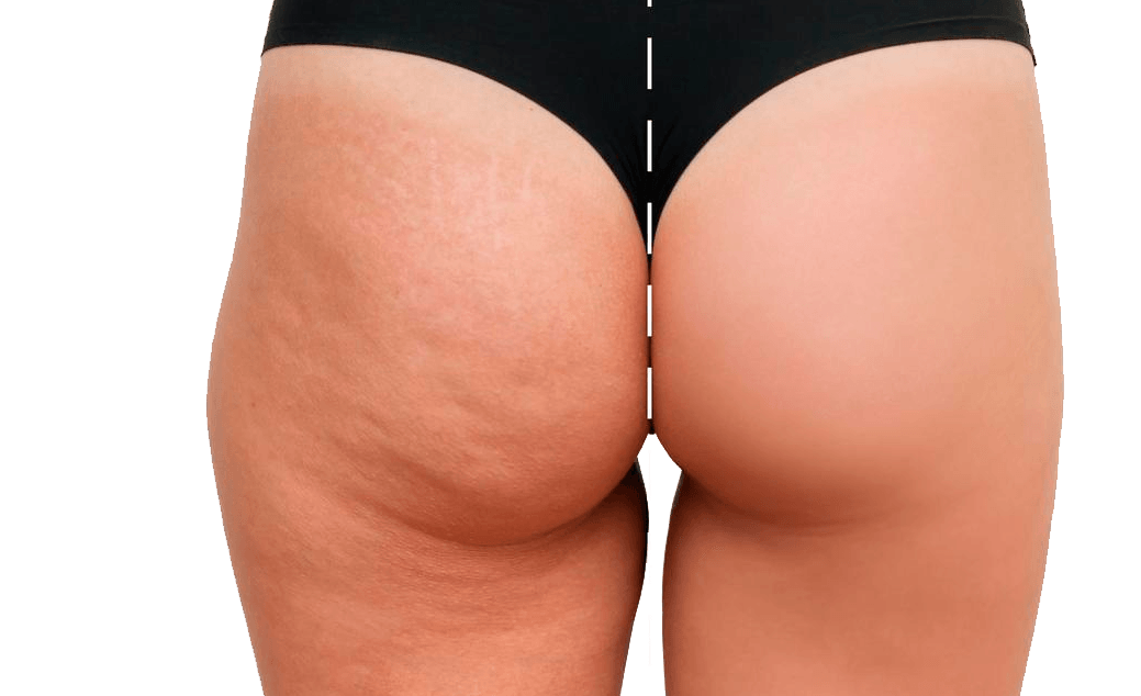 Beneficios visual